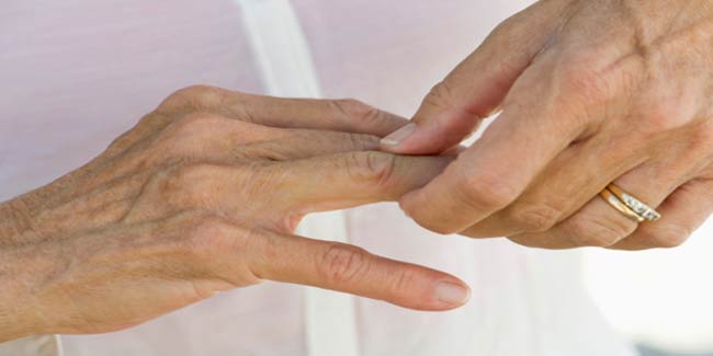 Psoriatic Arthritis : Symptoms and signs